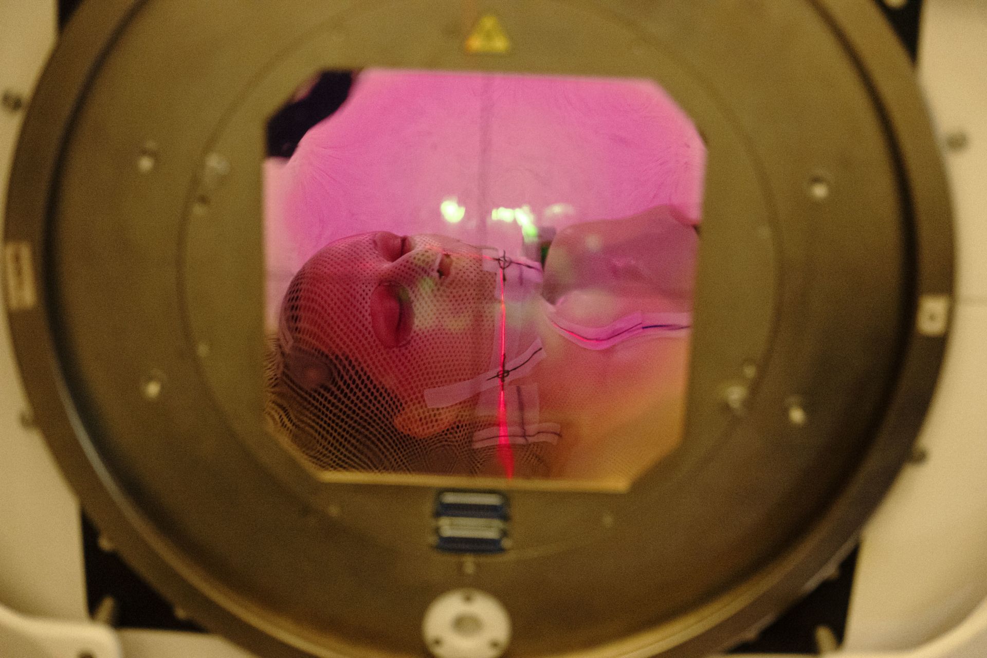 A photograph of a patient undergoing radiation therapy illustrates the medical context of the crosshairs